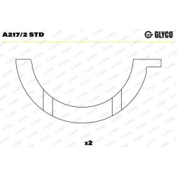 PSA DV4/DV6 TD/TED/TED4 1.4L / 1.6L HDI 8/16V A217/2 STD LE JEU